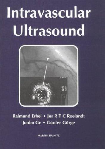 Intravascular Ultrasound by Gunter Gorge, Jos R. T. C. Roelandt, Raimund…