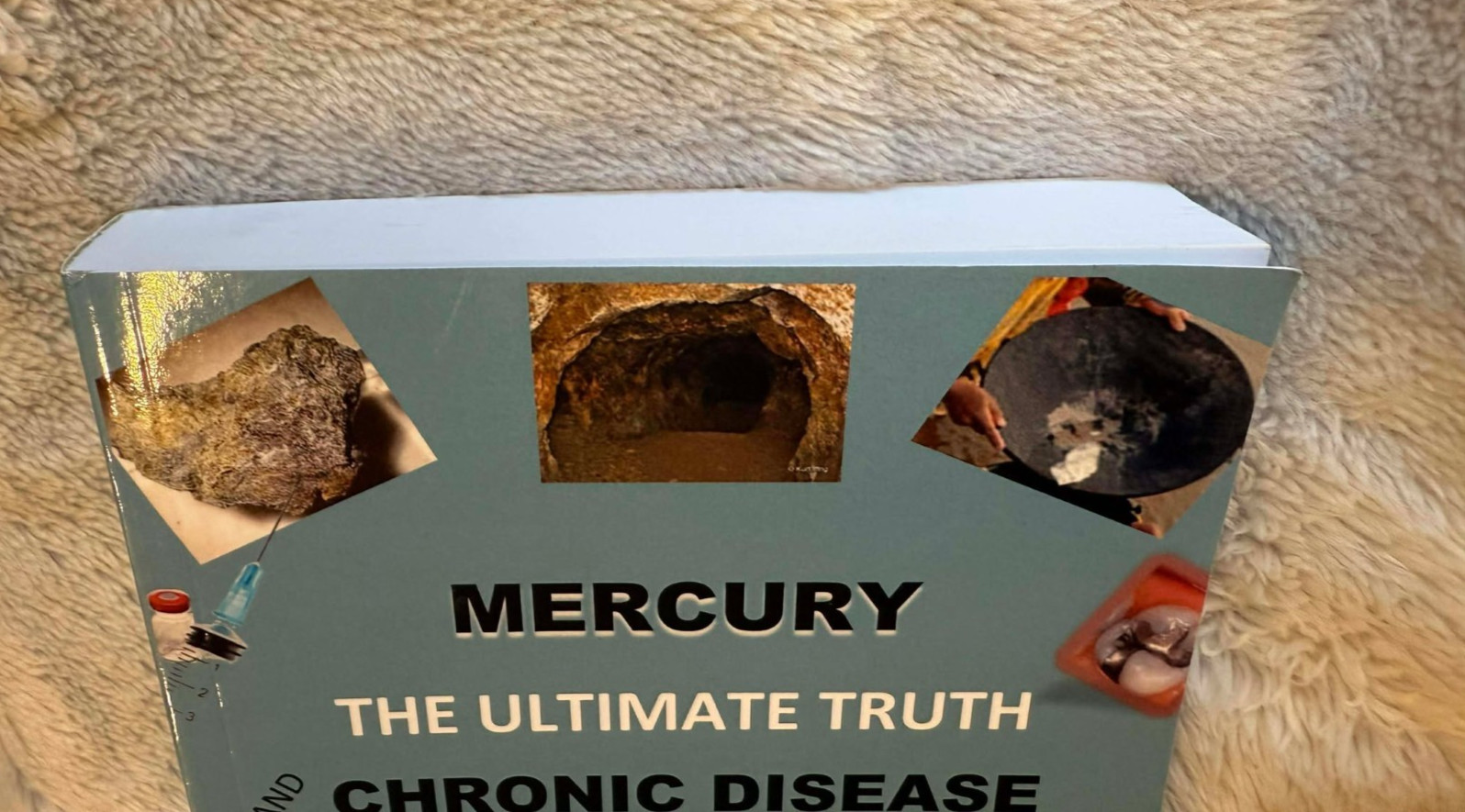 Mercury The Ultimate Truth and Chronic Disease 9781799136415