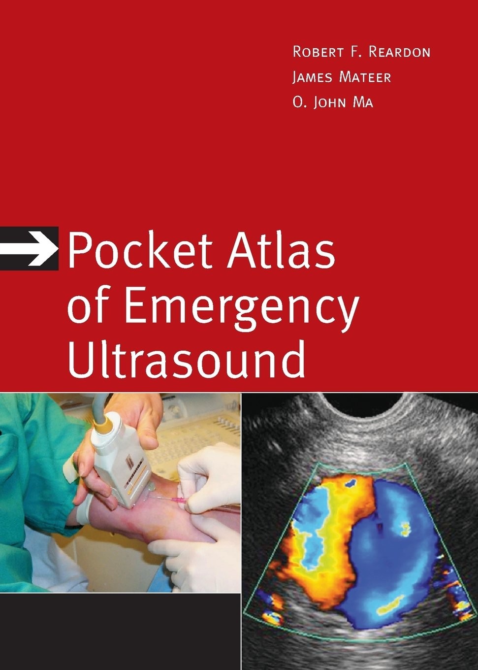 Pocket Atlas of Emergency Ultrasound (Atlas Series)