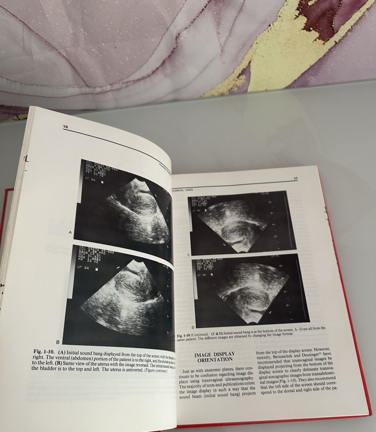 TRANSVAGINAL ULTRASOUND HARDCOVER TEXTBOOK MELVIN DODSON 1991 COPYRIGHT